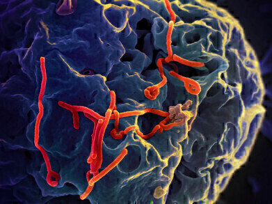 Can Chromatography Help Cure Ebola?
